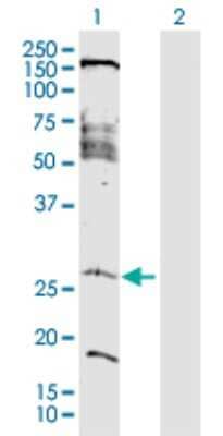 Western Blot: FAM177A1 Antibody [H00283635-D01P] - Analysis of FAM177A1 expression in transfected 293T cell line by FAM177A1 polyclonal antibody.Lane 1: C14orf24 transfected lysate(23.80 KDa).Lane 2: Non-transfected lysate.