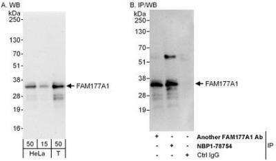 Western Blot: FAM177A1 Antibody [NBP1-78754] - Whole cell lysate from HeLa (15 and 50 mcg for WB; 1 mg for IP, 20% of IP loaded) and 293T (T; 50 mcg) cells.   Affinity purified rabbit anti-FAM177A1 antibody used for WB at 0.1 mcg/ml (A) and 1 mcg/ml (B) and used for IP at 6 mcg/mg lysate.  FAM177A1 was also immunoprecipitated by another rabbit anti-FAM177A1 antibody which recognizes an upstream epitope.