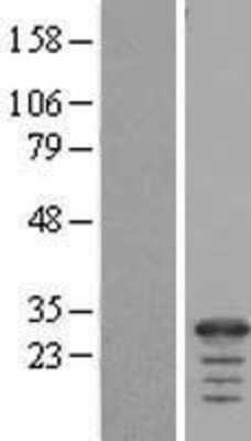 Western Blot: FAM177A1 Overexpression Lysate (Adult Normal) [NBL1-10504] Left-Empty vector transfected control cell lysate (HEK293 cell lysate); Right -Over-expression Lysate for FAM177A1.
