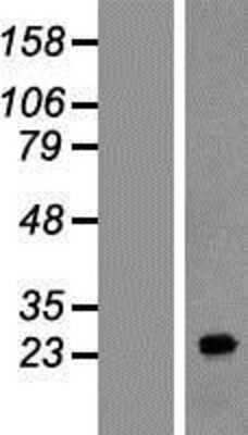 Western Blot: FAM177A1 Overexpression Lysate (Adult Normal) [NBP2-05123] Left-Empty vector transfected control cell lysate (HEK293 cell lysate); Right -Over-expression Lysate for FAM177A1.