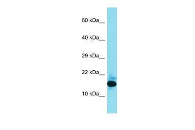 Western Blot: FAM177B Antibody [NBP2-82627] - Host: Rabbit. Target Name: FAM177B. Sample Type: 721_B Whole Cell lysates. Antibody Dilution: 1.0ug/ml