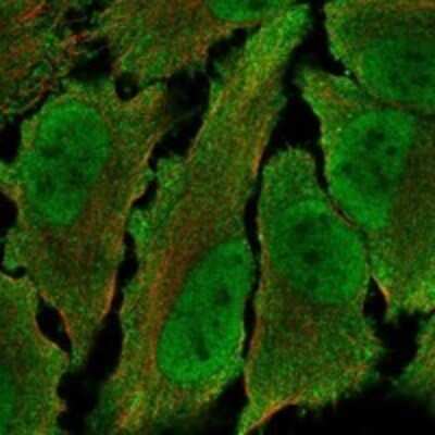 Immunocytochemistry/ Immunofluorescence FAM179A Antibody - BSA Free