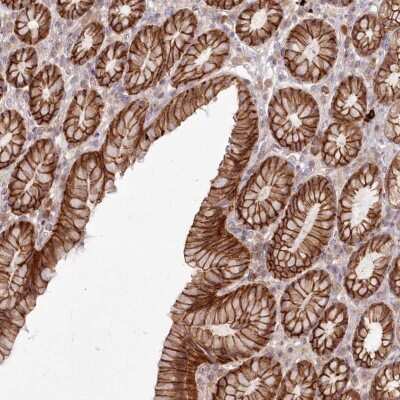 Immunohistochemistry FAM179A Antibody - BSA Free