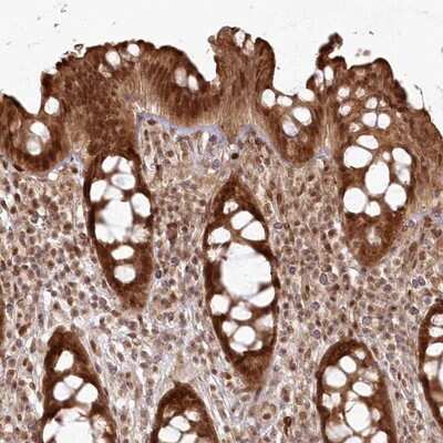 Immunohistochemistry-Paraffin FAM179A Antibody - BSA Free
