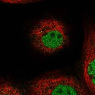 Immunocytochemistry/Immunofluorescence: FAM179B Antibody [NBP2-58610] - Staining of human cell line A-431 shows localization to nucleoplasm. Antibody staining is shown in green.