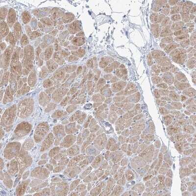 Immunohistochemistry-Paraffin: FAM184A Antibody [NBP1-86741] - Staining of human heart muscle shows moderate cytoplasmic positivity in myocytes.