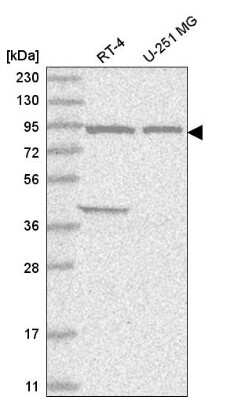 Western Blot: FAM184A Antibody [NBP2-56733] - Western blot analysis in human cell line RT-4 and human cell line U-251 MG.