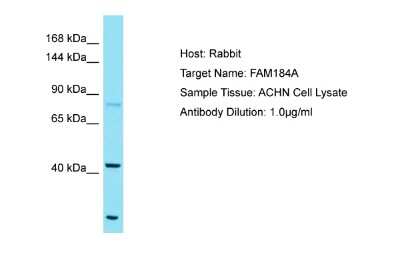 Western Blot: FAM184A Antibody [NBP2-87408] - Host: Rabbit. Target Name: FAM184A. Sample Tissue: Human ACHN Whole Cell. Antibody Dilution: 1ug/ml