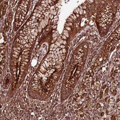 Immunohistochemistry-Paraffin: FAM186A Antibody [NBP1-93553] - Staining of human stomach, upper shows strong cytoplasmic positivity in glandular cells.