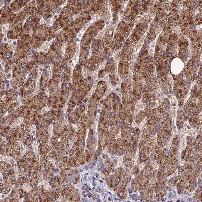 Immunohistochemistry-Paraffin: FAM186B Antibody [NBP1-88390] - Staining of human liver shows strong cytoplasmic positivity in hepatocytes.