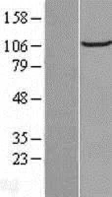 Western Blot: FAM186B Overexpression Lysate (Adult Normal) [NBL1-08131] Left-Empty vector transfected control cell lysate (HEK293 cell lysate); Right -Over-expression Lysate for FAM186B.