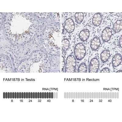Immunocytochemistry/Immunofluorescence: FAM187B Antibody [NBP3-17137] - Analysis in human testis and rectum tissues using Anti-FAM187B antibody. Corresponding FAM187B RNA-seq data are presented for the same tissues.