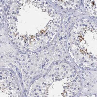 Immunohistochemistry-Paraffin: FAM187B Antibody [NBP3-17137] - Staining of human testis shows high expression.