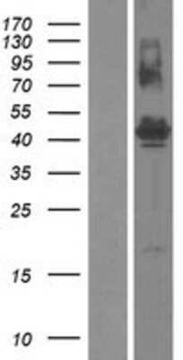 Western Blot: FAM187B Overexpression Lysate (Adult Normal) [NBP2-05353] Left-Empty vector transfected control cell lysate (HEK293 cell lysate); Right -Over-expression Lysate for FAM187B.