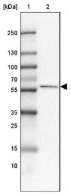 Western Blot: FAM189A1 Antibody [NBP1-93631] - Lane 1: Marker  [kDa] 250, 130, 100, 70, 55, 35, 25, 15, 10.  Lane 2: Liver