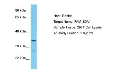 Western Blot: FAM189A1 Antibody [NBP2-84903] - Host: Rabbit. Target Name: FAM189A1. Sample Type: 293T Whole Cell lysates. Antibody Dilution: 1.0ug/ml