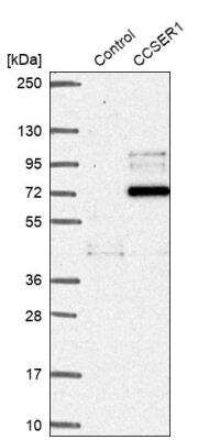 Western Blot FAM190A Antibody