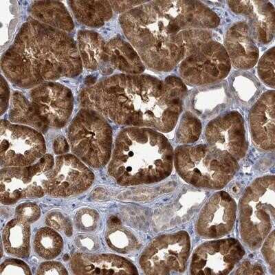 Immunohistochemistry-Paraffin: FAM194A Antibody [NBP2-14638] - Staining of human kidney shows strong cytoplasmic positivity in cells in tubules.