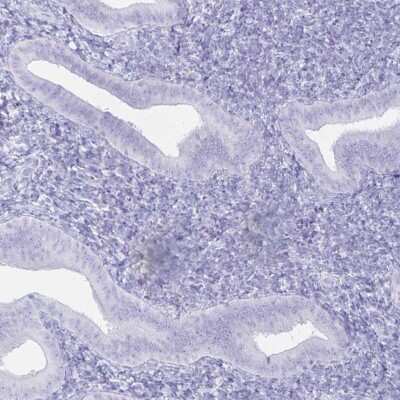 Immunohistochemistry-Paraffin: FAM194A Antibody [NBP2-14638] - Staining of human endometrium shows low expression as expected.