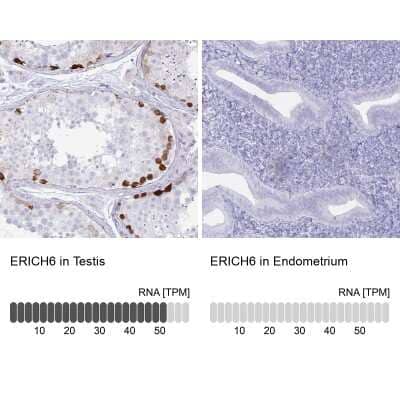 Immunohistochemistry-Paraffin: FAM194A Antibody [NBP2-14638] - Staining in human testis and endometrium tissues using anti-ERICH6 antibody. Corresponding ERICH6 RNA-seq data are presented for the same tissues.