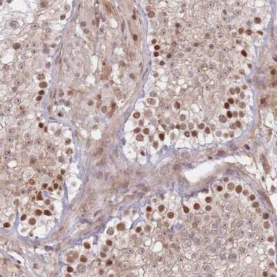 Immunohistochemistry-Paraffin: FAM194B Antibody [NBP2-31011] - Staining of human testis shows strong nuclear positivity in spermatogonia.