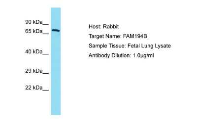 Western Blot: FAM194B Antibody [NBP2-82646] - Host: Rabbit. Target Name: FAM194B. Sample Type: Fetal Lung lysates. Antibody Dilution: 1.0ug/ml