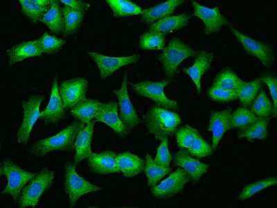 Immunocytochemistry/Immunofluorescence: FAM195B Antibody [NBP2-97514] - Immunofluorescence staining of FAM195B in U2OS cells. Cells were fixed with 4% PFA, permeabilzed with 0.1% Triton X-100 in PBS, blocked with 10% serum, and incubated with rabbit anti-Human FAM195B polyclonal antibody (dilution ratio 1:200) at 4C overnight. Then cells were stained with the Alexa Fluor(R)488-conjugated Goat Anti-rabbit IgG secondary antibody (green) and counterstained with DAPI (blue).Positive staining was localized to Cytoplasm.