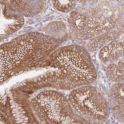 Immunohistochemistry-Paraffin: FAM196B Antibody [NBP2-14588] - Staining of human stomach, lower shows strong cytoplasmic and membranous positivity in glandular cells.