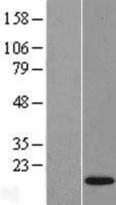 Western Blot: FAM19A4 Overexpression Lysate (Adult Normal) [NBL1-10511] Left-Empty vector transfected control cell lysate (HEK293 cell lysate); Right -Over-expression Lysate for FAM19A4.