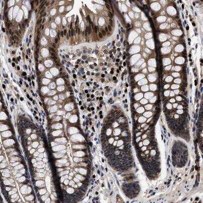 Immunohistochemistry FAM200A Antibody - BSA Free