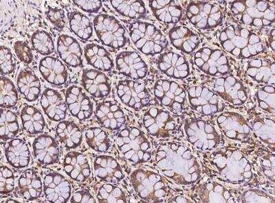 Immunohistochemistry-Paraffin: FAM200A Antibody [NBP3-05968] - Staining of human FAM200A in human rectum with rabbit polyclonal antibody at 1:500 dilution.