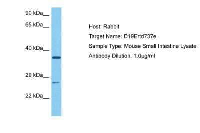 Western Blot: FAM204A Antibody [NBP2-84907] - Host: Rabbit. Target Name: D19ERTD737E. Sample Tissue: Mouse Small Intestine lysates. Antibody Dilution: 1ug/ml