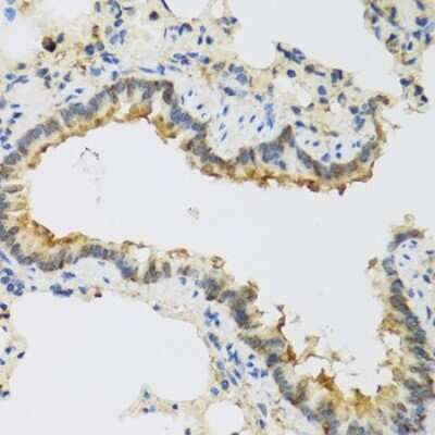Immunohistochemistry-Paraffin: FAM20A Antibody [NBP3-04714] - Paraffin-embedded rat lung using FAM20A antibody at dilution of 1:100 (40x lens).