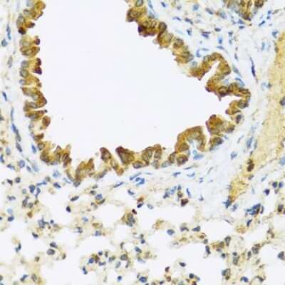 Immunohistochemistry-Paraffin: FAM20A Antibody [NBP3-04714] - Paraffin-embedded mouse lung using FAM20A antibody at dilution of 1:100 (40x lens).