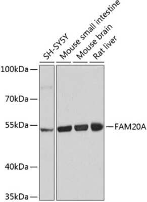 Western Blot: FAM20A Antibody [NBP3-04714] - Analysis of extracts of various cell lines, using FAM20A antibody at 1:1000 dilution. Secondary antibody: HRP Goat Anti-Rabbit IgG (H+L) at 1:10000 dilution. Lysates/proteins: 25ug per lane. Blocking buffer: 3% nonfat dry milk in TBST. Detection: ECL Basic Kit