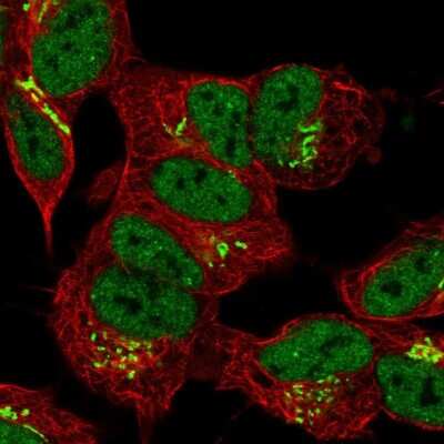 Immunocytochemistry/Immunofluorescence: FAM20B Antibody [NBP1-81506] - Immunofluorescent staining of human cell line SH-SY5Y shows localization to nucleoplasm & the Golgi apparatus.