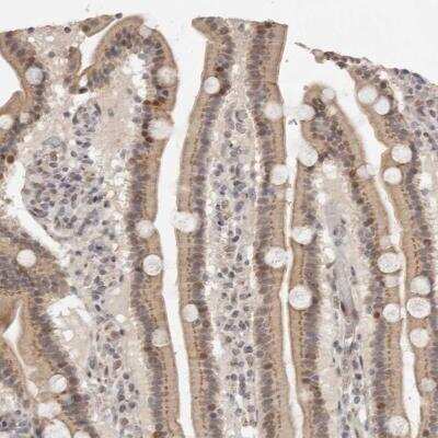 Immunohistochemistry: FAM211A Antibody [NBP1-93828] - Immunohistochemical staining of human duodenum shows moderate cytoplasmic and nuclear positivity in glandular cells.