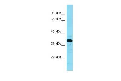 Western Blot: FAM212A Antibody [NBP2-84909] - Host: Rabbit. Target Name: FAM212A. Sample Type: Fetal Liver lysates. Antibody Dilution: 1.0ug/ml