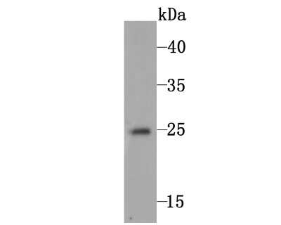 Western Blot: FAM213A Antibody (7-B7) [NBP2-75486] - Analysis of C10orf58 on human skin tissue lysate using anti-C10orf58 antibody at 1/1000 dilution.