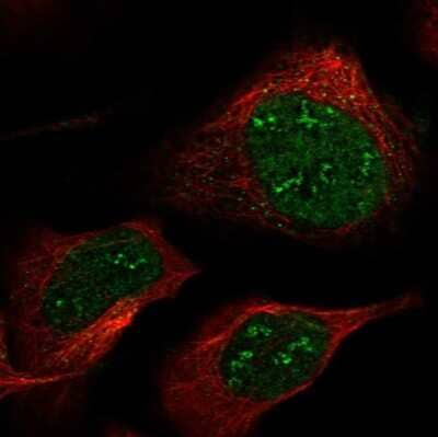 Immunocytochemistry/Immunofluorescence: FAM214B Antibody [NBP2-13993] - Staining of human cell line U-2 OS shows localization to nucleus & nucleoli fibrillar center.