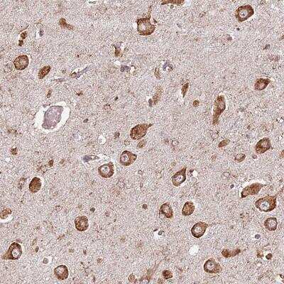 Immunohistochemistry-Paraffin: FAM214B Antibody [NBP2-13993] - Staining of human hippocampus shows strong cytoplasmic positivity in neuronal cells.