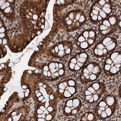 Immunohistochemistry-Paraffin FAM216B Antibody - BSA Free