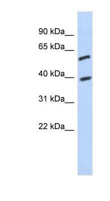 Western Blot: FAM217A Antibody [NBP1-91462] - Titration: 0.2-1 ug/ml, Positive Control: Jurkat cell lysate.