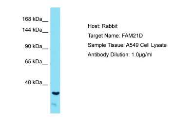 Western Blot: FAM21A Antibody [NBP2-87416] - Host: Rabbit. Target Name: FAM21A. Sample Tissue: Human A549 Whole Cell. Antibody Dilution: 1ug/ml