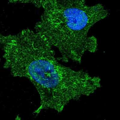 Immunocytochemistry/Immunofluorescence: FAM222A Antibody [NBP1-82225] - Immunofluorescent staining of human cell line U-251 MG shows localization to nucleoplasm, plasma membrane, mitochondria & focal adhesion sites.