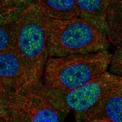Immunocytochemistry/Immunofluorescence: FAM222A Antibody [NBP3-17365] - Staining of human cell line MCF7 shows localization to nucleoplasm & plasma membrane.