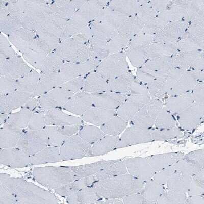 Immunohistochemistry-Paraffin: FAM222A Antibody [NBP1-82225] - Staining of human skeletal muscle shows no positivity in myocytes as expected.