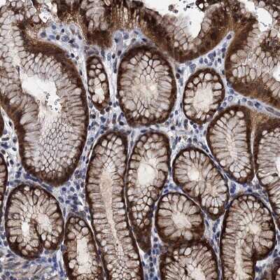 Immunohistochemistry-Paraffin: FAM222A Antibody [NBP1-82225] - Staining of human stomach shows strong membranous positivity in glandular cells.