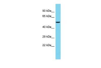 Western Blot: FAM222B Antibody [NBP2-84914] - Host: Rabbit. Target Name: FAM222B. Sample Type: PANC1 Whole Cell lysates. Antibody Dilution: 1.0ug/ml
