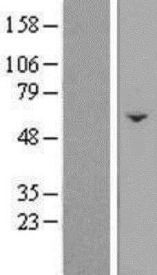 Western Blot: FAM222B Overexpression Lysate (Native) [NBP2-08460] - FAM222B Overexpression Lysate (Native) Left-Empty vector transfected control cell lysate (HEK293 cell lysate); Right -Over-expression Lysate for C17orf63.